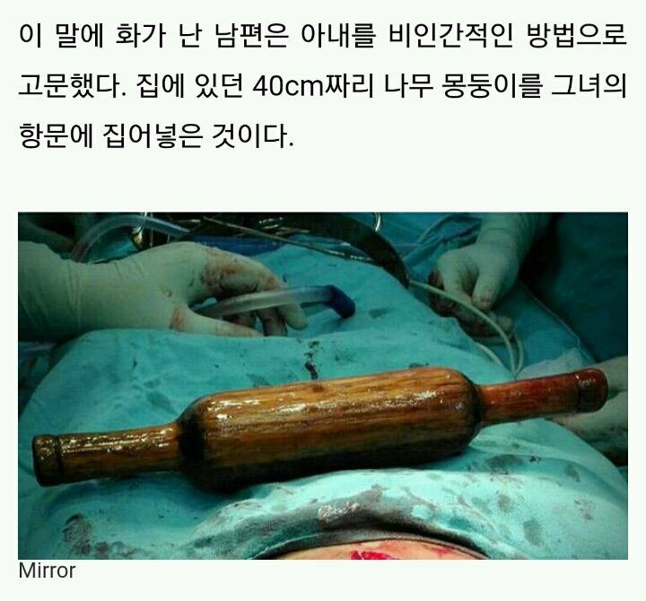 불임 판정 받은 아내 항문에 '40cm' 몽둥이 넣고 고문한 남편 | 인스티즈