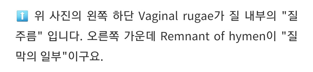 너네 * 쳐녀막 대체어 * 프로젝트 진행된거 혹시 알고 있니?(성에 대해 궁금하고 무지해도 다 들어와라) | 인스티즈