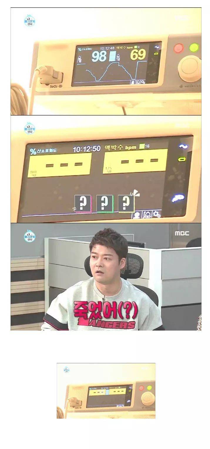 나혼자산다)이시언 수면내시경 ㅋㅋㅋㅋ | 인스티즈