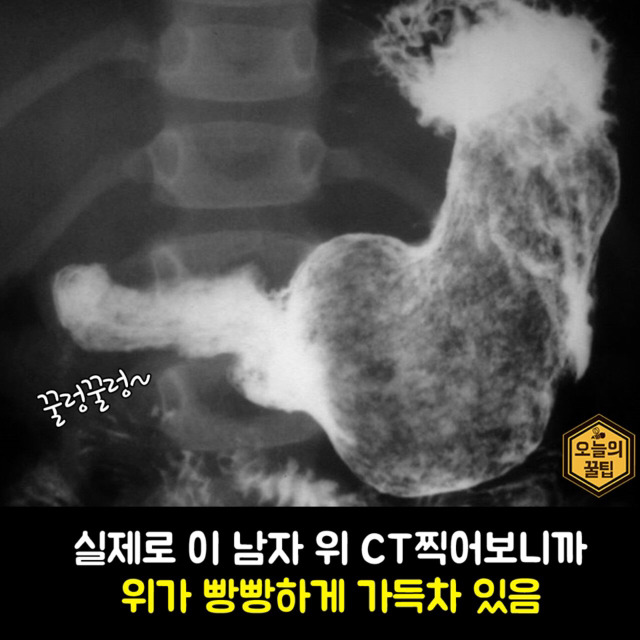 여자들이 밥먹고 또 케익을 먹는 과학적인 이유 | 인스티즈