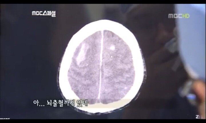 음주운전으로 피해자는 온몸이 다부서졌는데 가해자는 아무것도 없는사람(피주의) | 인스티즈