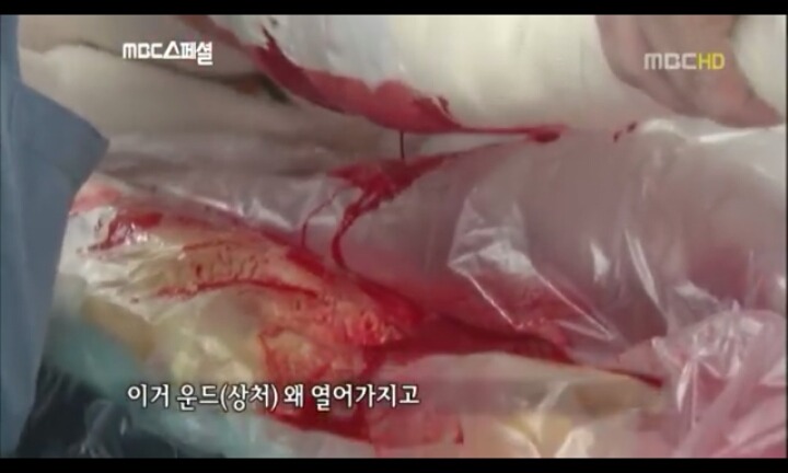 음주운전으로 피해자는 온몸이 다부서졌는데 가해자는 아무것도 없는사람(피주의) | 인스티즈