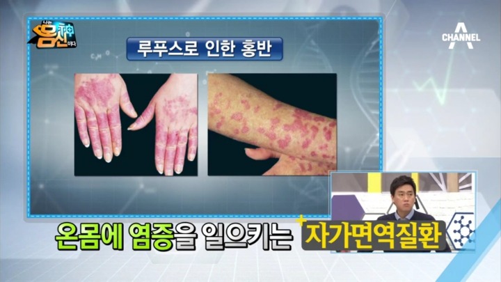 셀레나 고메즈가 친구에게 신장이식 받은 이유.jpg | 인스티즈