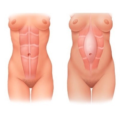 학교나 사회가 알려주지 않는 임신과 출산의 진짜 현실 | 인스티즈