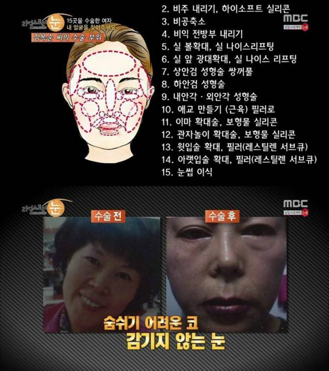 약혐,분노)사이코패스같은 의사 | 인스티즈