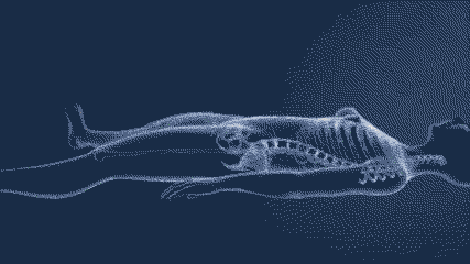 트랜스젠더 되는 수술 gif | 인스티즈