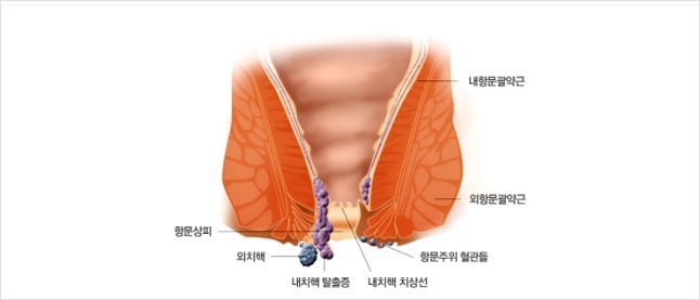 똥꼬에게 사과정도는 해라 | 인스티즈