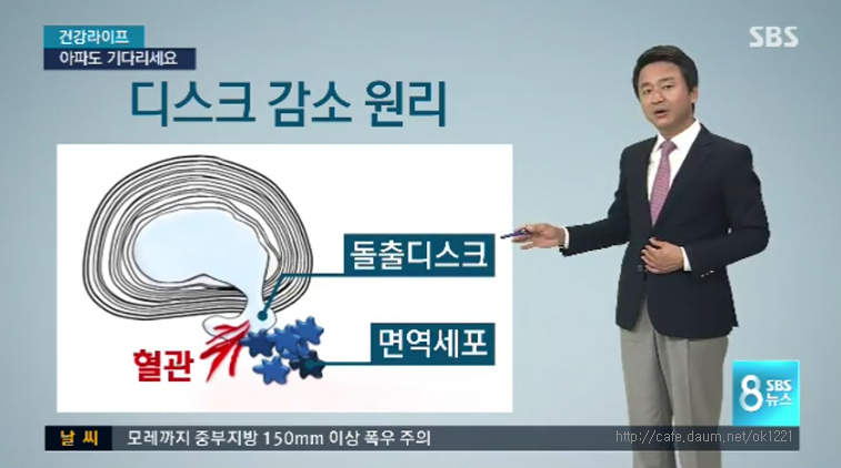 허리디스크는 시간이 약.jpg | 인스티즈