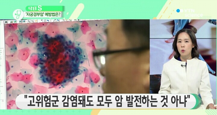 자궁경부암의 전조증상.jpg | 인스티즈