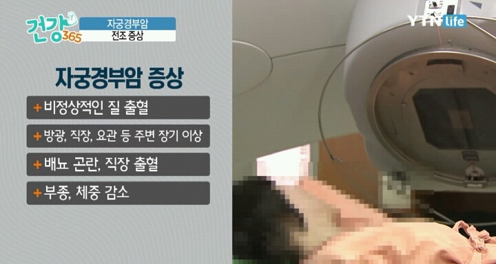 자궁경부암의 전조증상.jpg | 인스티즈