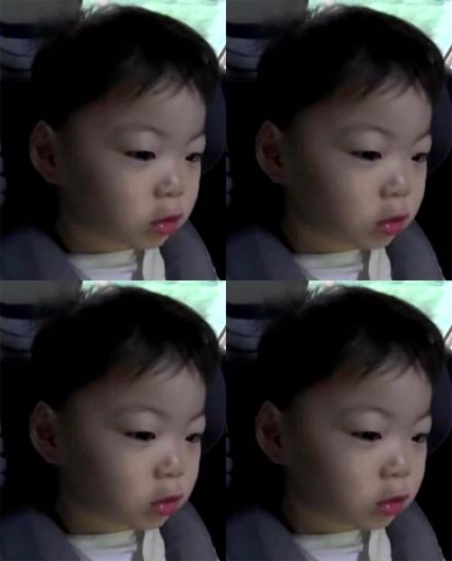 송만세와 사랑니 | 인스티즈