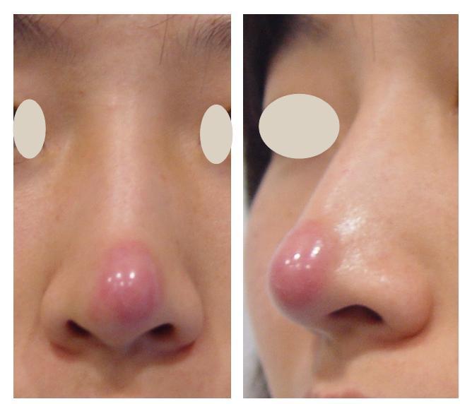 성형외과 종사자들이 말하는 부작용 위험높은 수술 쓰리톱 (혐오주의) | 인스티즈