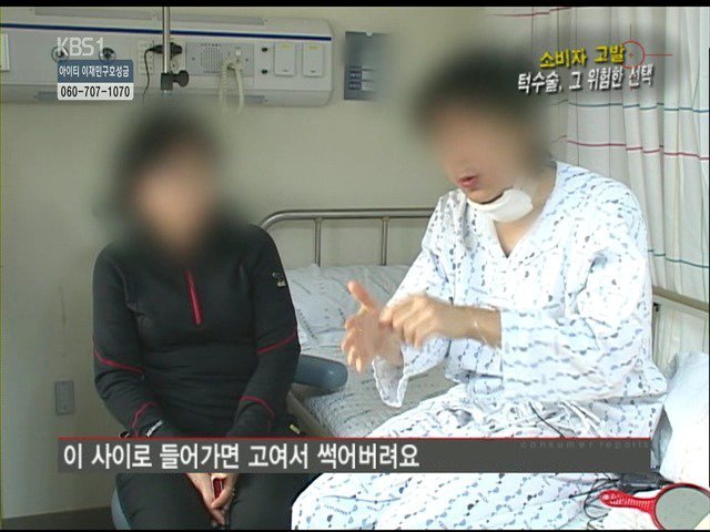 성형외과 종사자들이 말하는 부작용 위험높은 수술 쓰리톱 (혐오주의) | 인스티즈