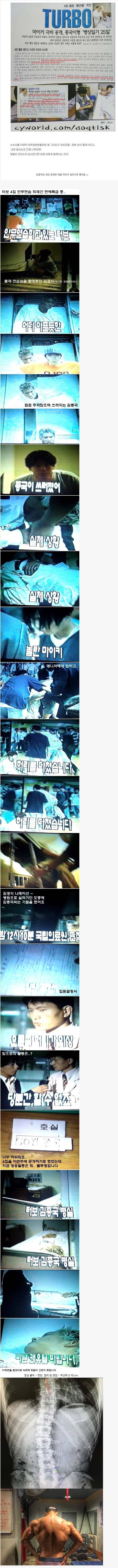 사람들이 잘 모르는 김종국 허리상태 | 인스티즈