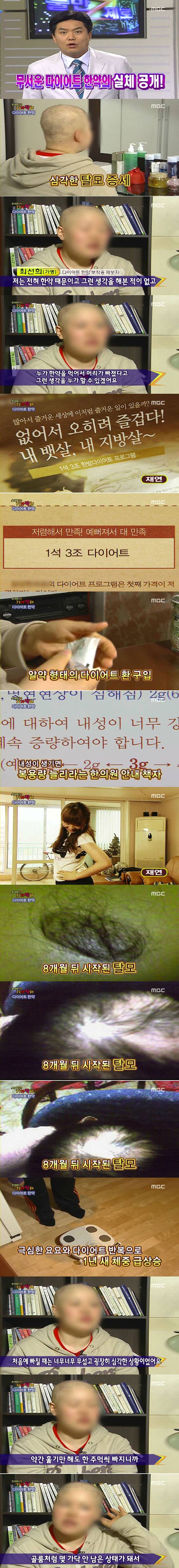 한약 다이어트 부작용 甲 | 인스티즈