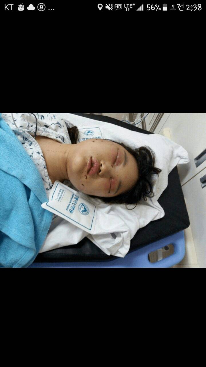 사진주의, 분노주의) 강릉 폭행사건 | 인스티즈