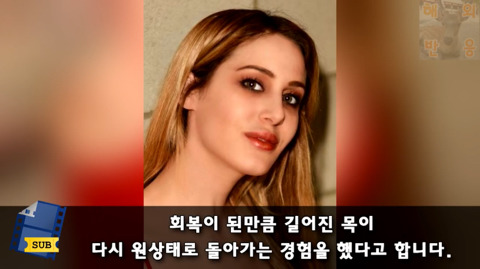 목 길이를 늘리기 위해 5년간 원주민들의 고리를 착용하고 다닌 미국인 | 인스티즈