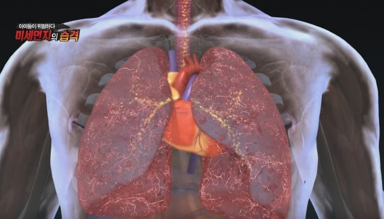 미세먼지가 위험한 진짜 이유 | 인스티즈