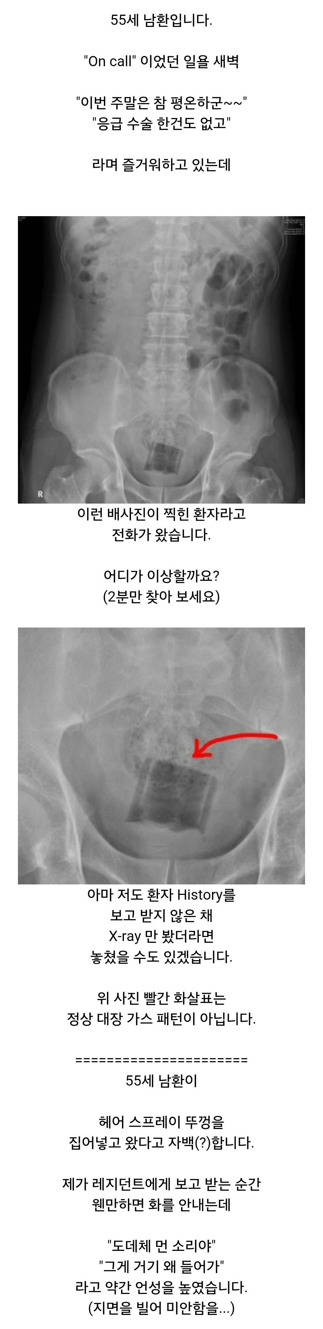항문에 자꾸 뭘 넣는 남환자들때문에 고통받는 응급실의사분들ㅋㅋㅋㅋ | 인스티즈