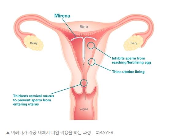 생리와 작별한 여성들 | 인스티즈