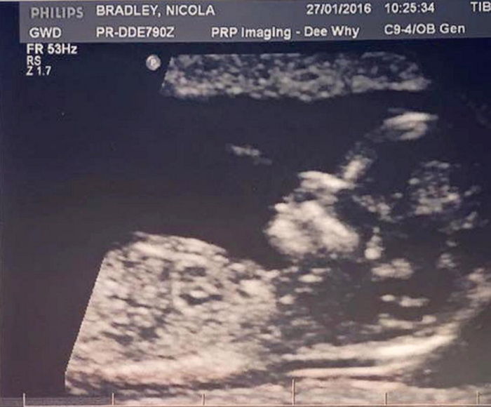 머리숱 왕 아기.JPG | 인스티즈