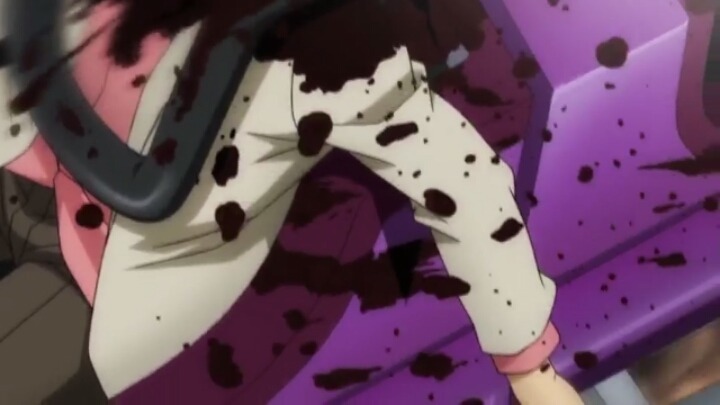 명탐정코난 일본판 피 vs 한국판 피..jpg | 인스티즈