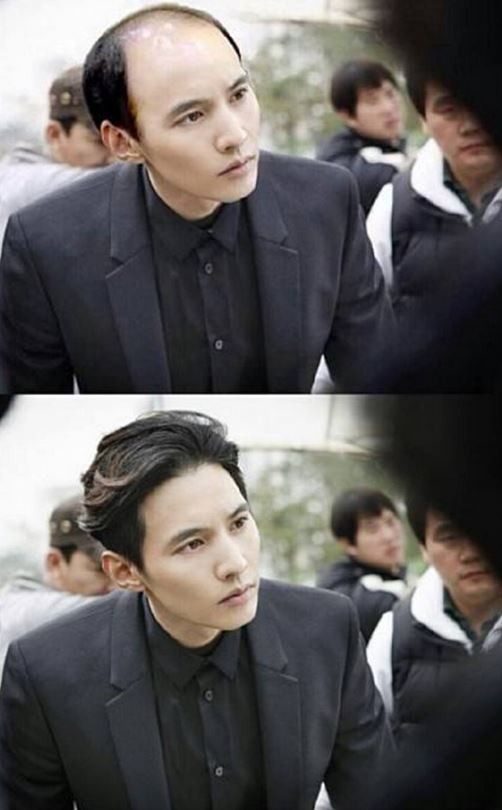 키 178cm + 서울대 졸업 + 입사 9년 차 은행원 + 3억 8천만 원 아파트 소유 스펙인데도 대머리면 까인다는 현실 (소리) | 인스티즈