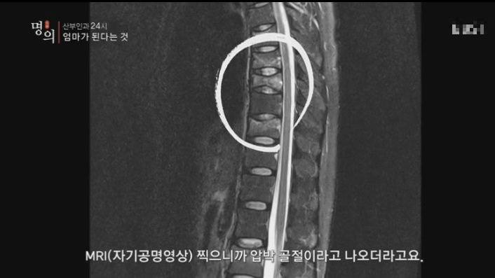 아무도 알려주지 않는 모유수유의 문제점 | 인스티즈