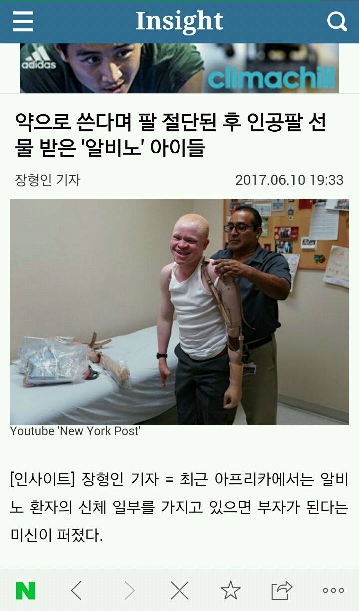 약으로 쓴다며 팔 절단된 후 인공팔 선물 받은 '알비노' 아이들 | 인스티즈