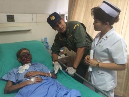 약물 알레르기로 인해 피해받는 사람(혐오주의) | 인스티즈