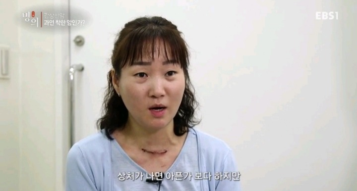 갑상선암 환자들이 듣는 말.jpg | 인스티즈