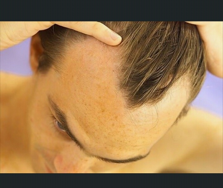 남자들에게 더 큰 스트레스는 탈모 vs 극악조루 | 인스티즈