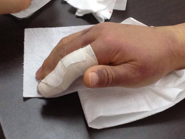 힐링캠프 출연했다 손가락 다쳤던 문재인 대통령님.jpg | 인스티즈