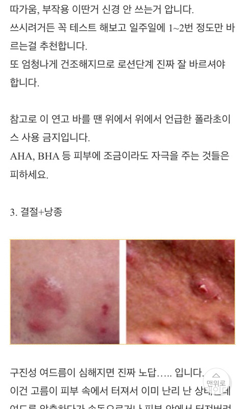  남자피부관리 온갖 여드름 종결 썰 | 인스티즈