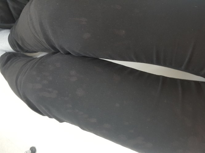 네덜란드 인터뷰에서 사고가 과장된 거라고 거짓말하는 스벤 크라머 | 인스티즈