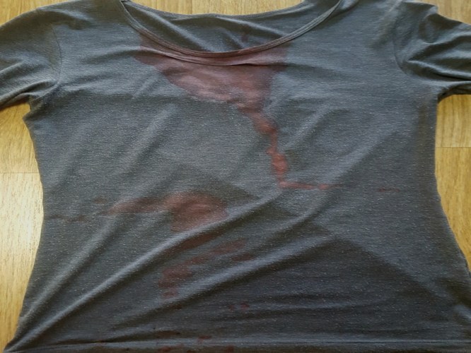 네덜란드 인터뷰에서 사고가 과장된 거라고 거짓말하는 스벤 크라머 | 인스티즈