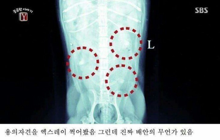 궁금한이야기Y 역대급 난제 ㄷㄷ | 인스티즈