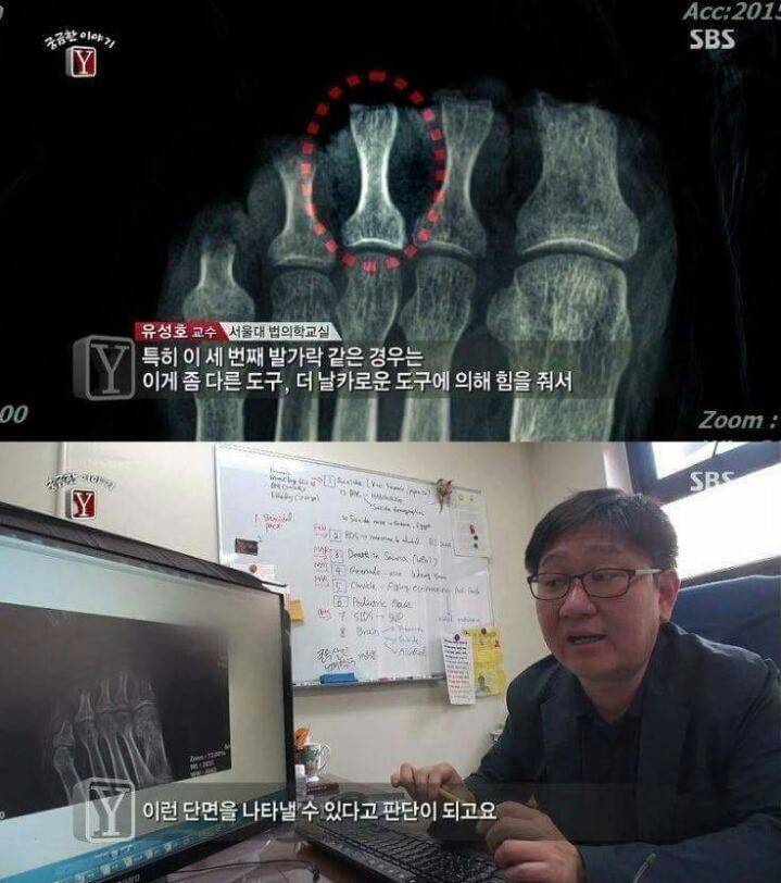 궁금한이야기Y 역대급 난제 ㄷㄷ | 인스티즈