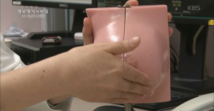 가슴에 멍울은 다 있는거 아님? 유방암이랑 뭐가 달라? | 인스티즈