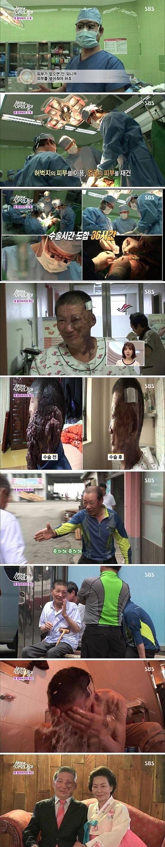 성형수술 레전드 | 인스티즈