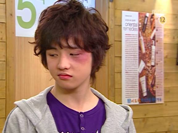 [거침없이하이킥] 민호보다 더 크게 다쳤는데 사람들이 몰라줘서 억울한 윤호.jpg | 인스티즈