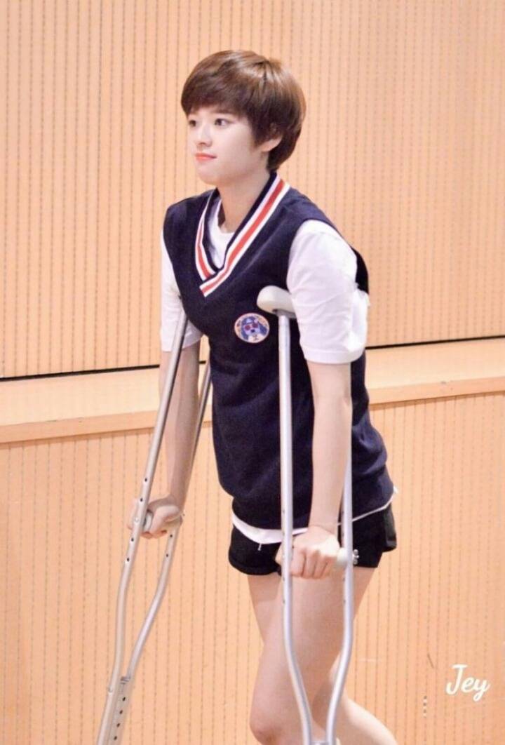 정법에서 다친후 목발짚는 트와이스 정연 | 인스티즈