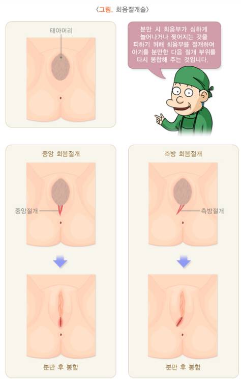 학교나 사회가 알려주지 않는 임신과 출산의 진짜 현실 | 인스티즈