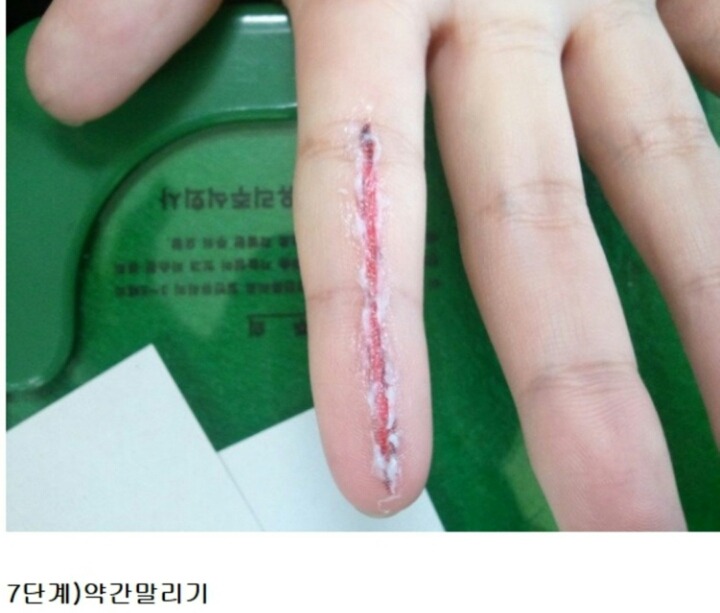 조퇴 쉽게 하는법 | 인스티즈