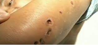 브라질말벌.JPG (혐오주의) | 인스티즈