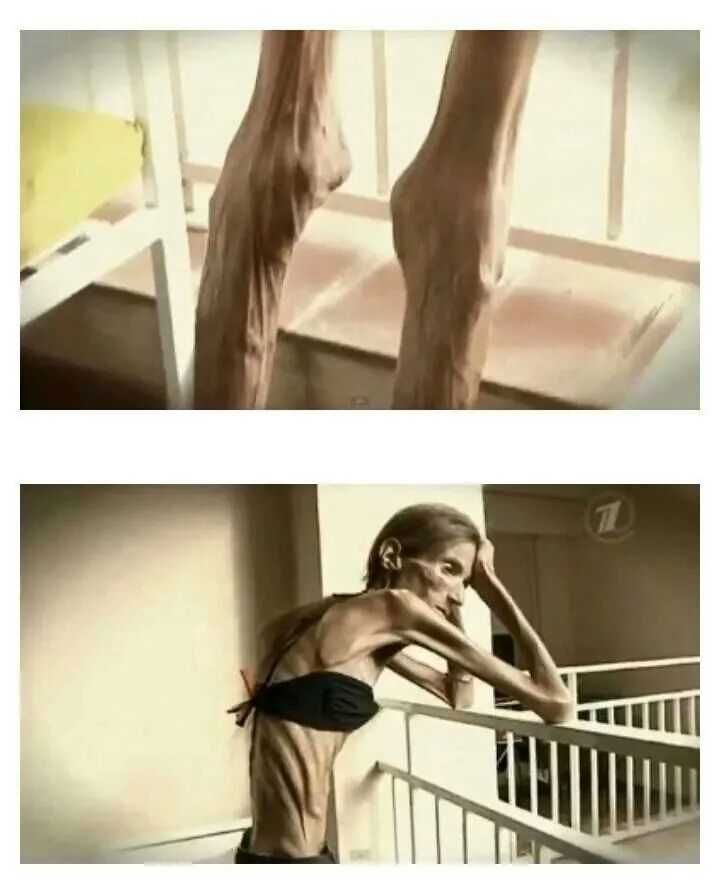 과도한 다이어트의 폐해 | 인스티즈