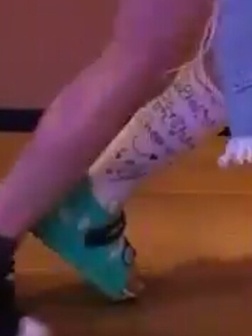 정법에서 다친후 목발짚는 트와이스 정연 | 인스티즈