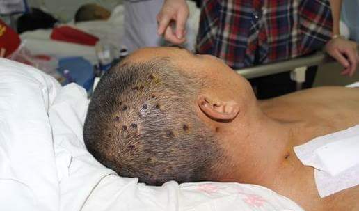 브라질말벌.JPG (혐오주의) | 인스티즈