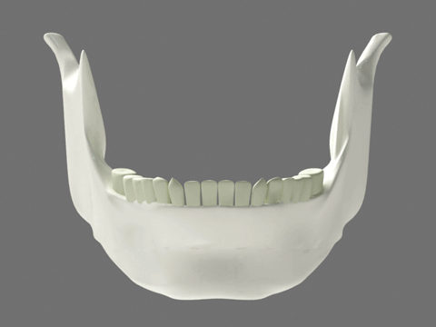 양악수술후 뼛조각 (혐오주의) | 인스티즈