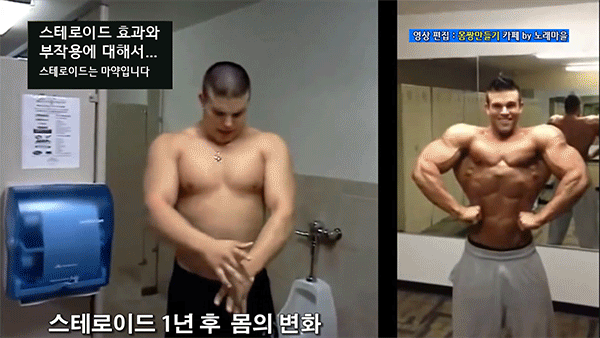 스테로이드 1년 맞으면 생기는 몸의 변화 | 인스티즈